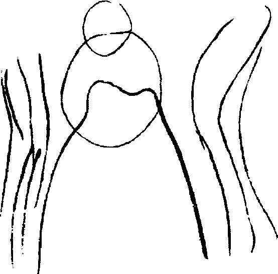 14 14