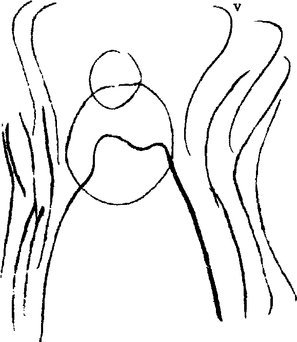 15 15